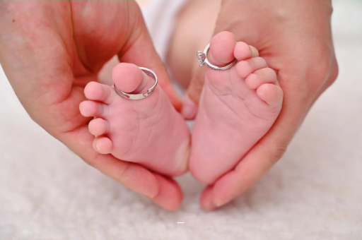 府谷孕妇肝内胆汁淤积症
